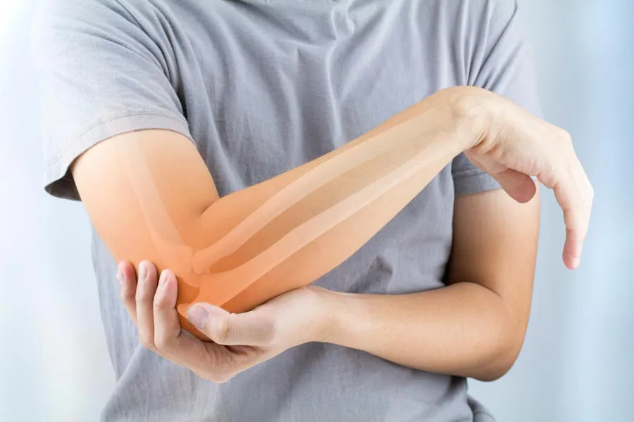 Osteoporosis-Doctor A close-up of a woman holding her elbow with an illustration of the bones and joint experiencing pain from osteoporosis. Get osteoporosis treatment from AZENA Health & Longevity in Gainesville.
